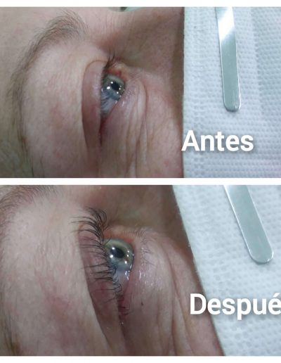 lifting y permanente 2